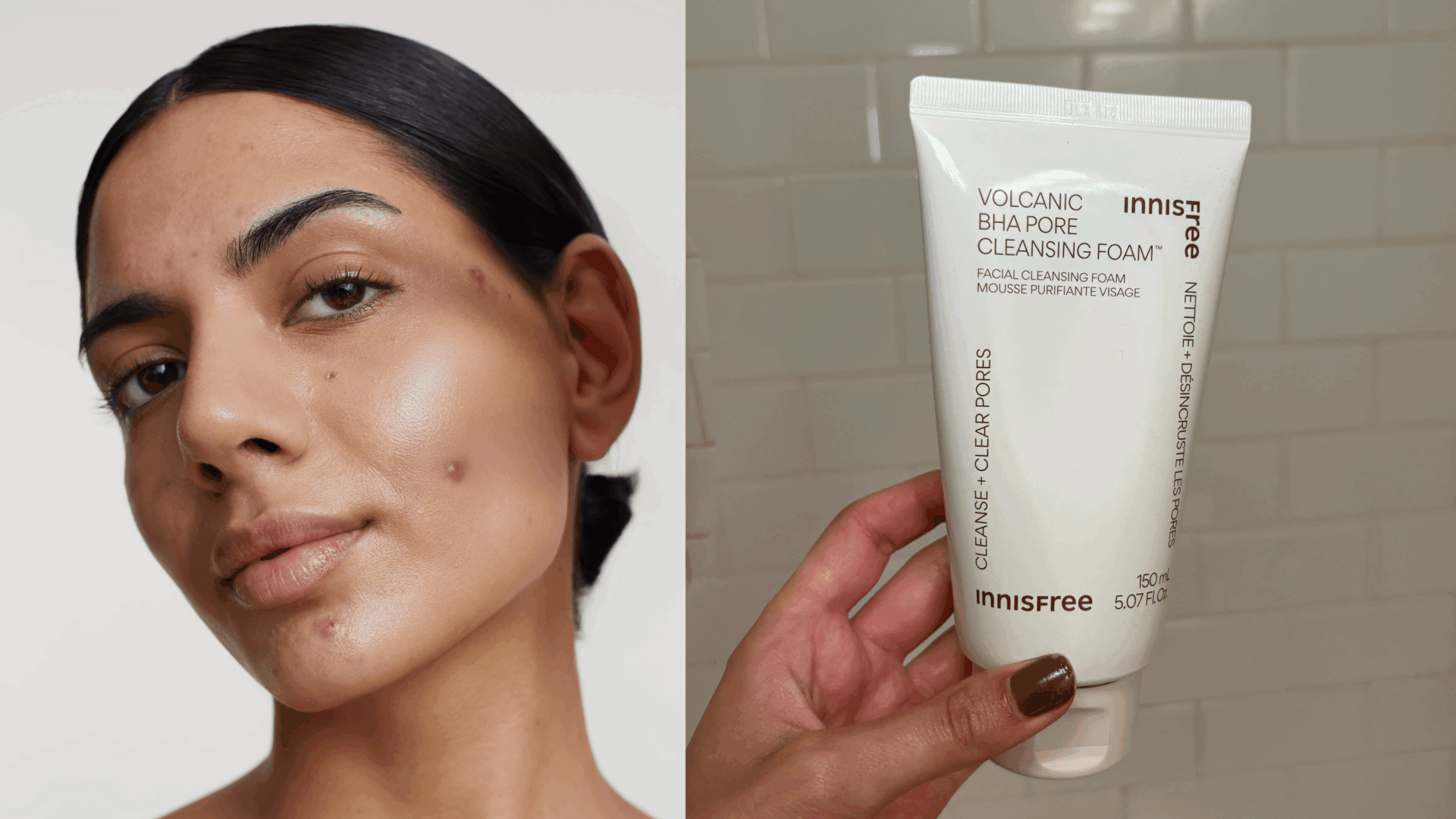 10 Best Face Washes for Acne 2025, According to Dermatologists