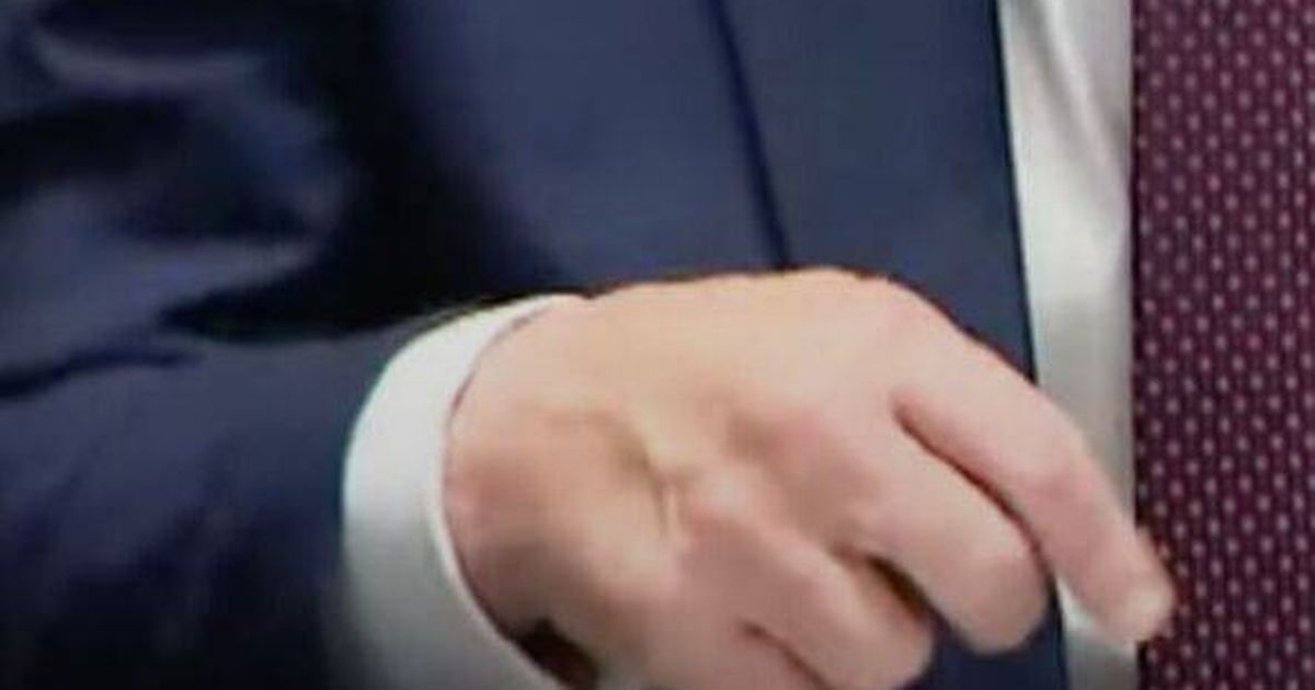 Donald Trump’s bruising mystery deepens as another shock photo emerges