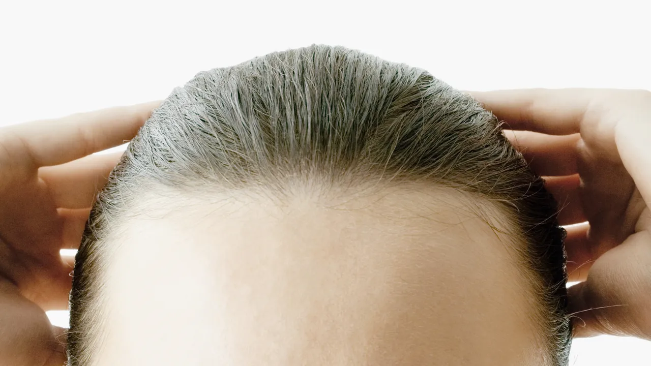 Do Slick-Back Updos Affect Your Hair Health?