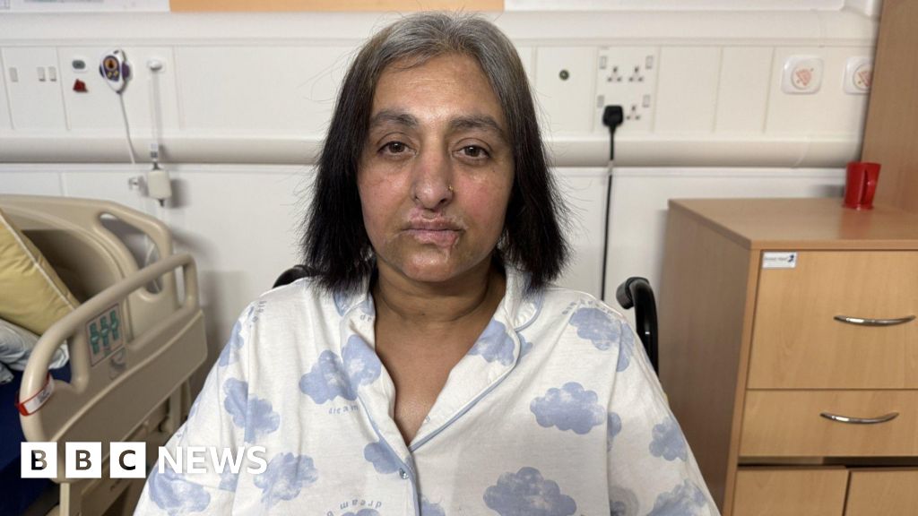 Sepsis warning after woman's quadruple amputation