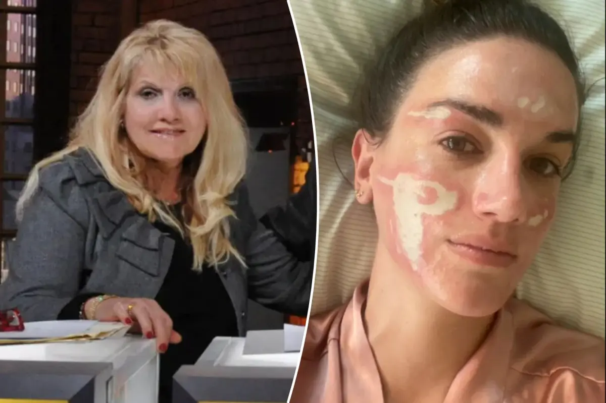 Celeb esthetician loses license after client says she was left ‘permanently scarred’