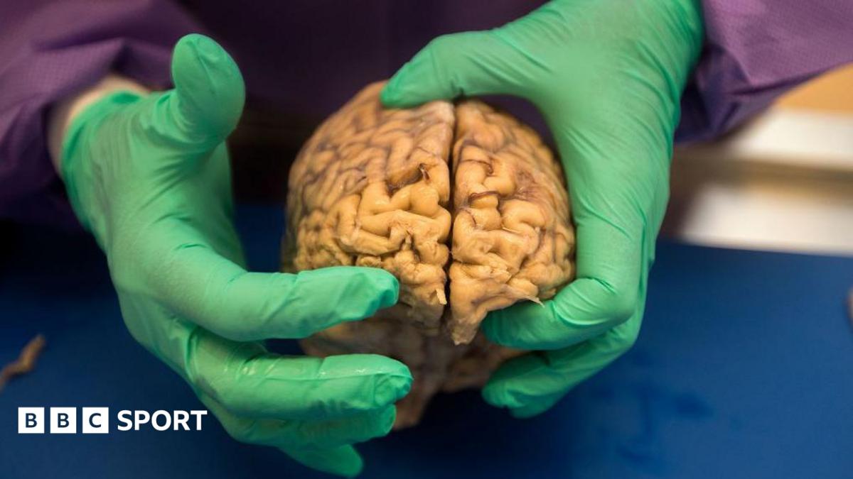 NFL: At least one in four ex-players had brain disease, says study